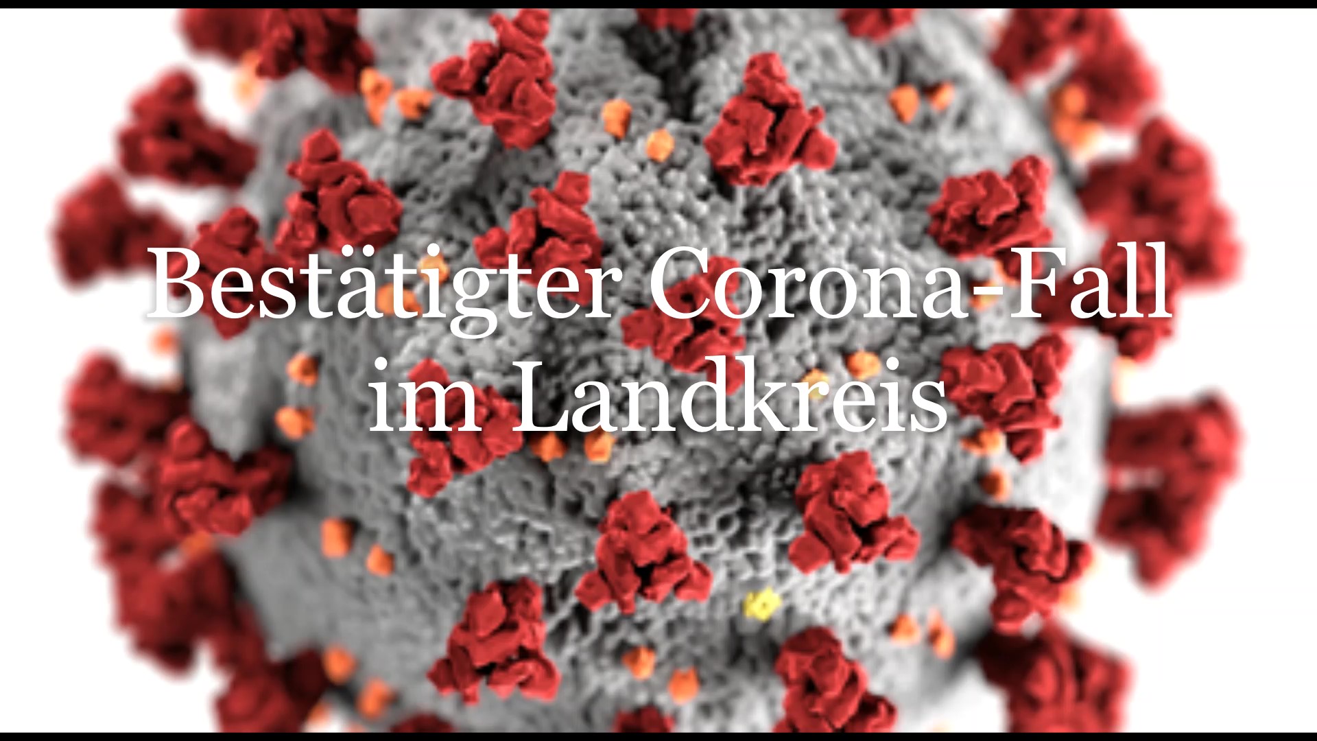 Erster bestätigter Corona-Fall im Landkreis Straubing-Bogen